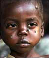 Malawian child