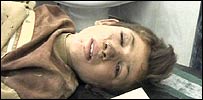 injuredboy_203.jpg